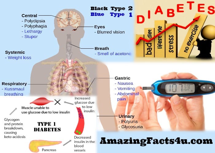 Diabetes Amazing facts