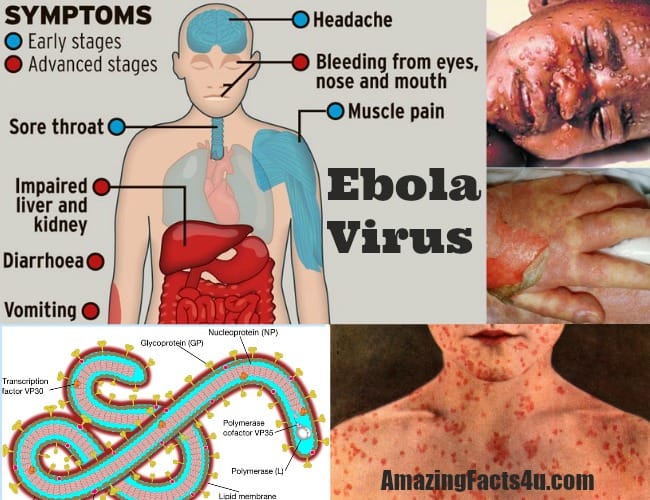Ebola Virus Amazing Facts