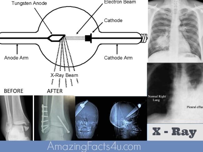 X Ray Amazing Facts