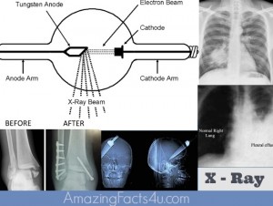 X - Ray Amazing Facts 4 u